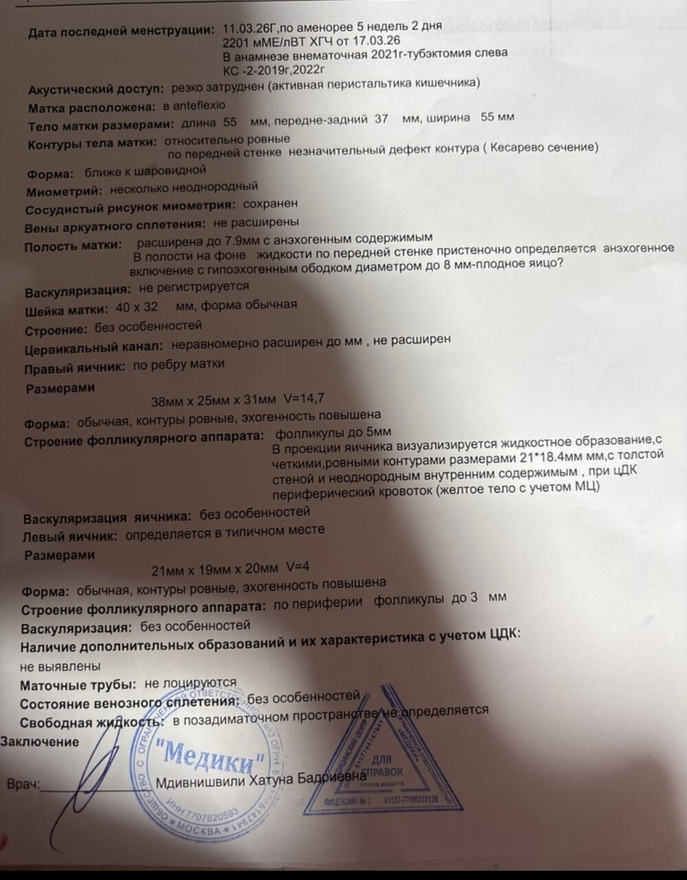 Помогите разобраться Признаки гематометры беременность ?